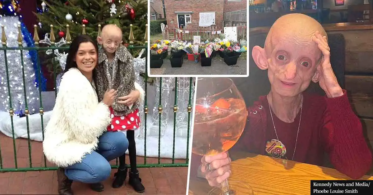 Teen with disease that aged her body to 144 years old died just weeks after turning 18