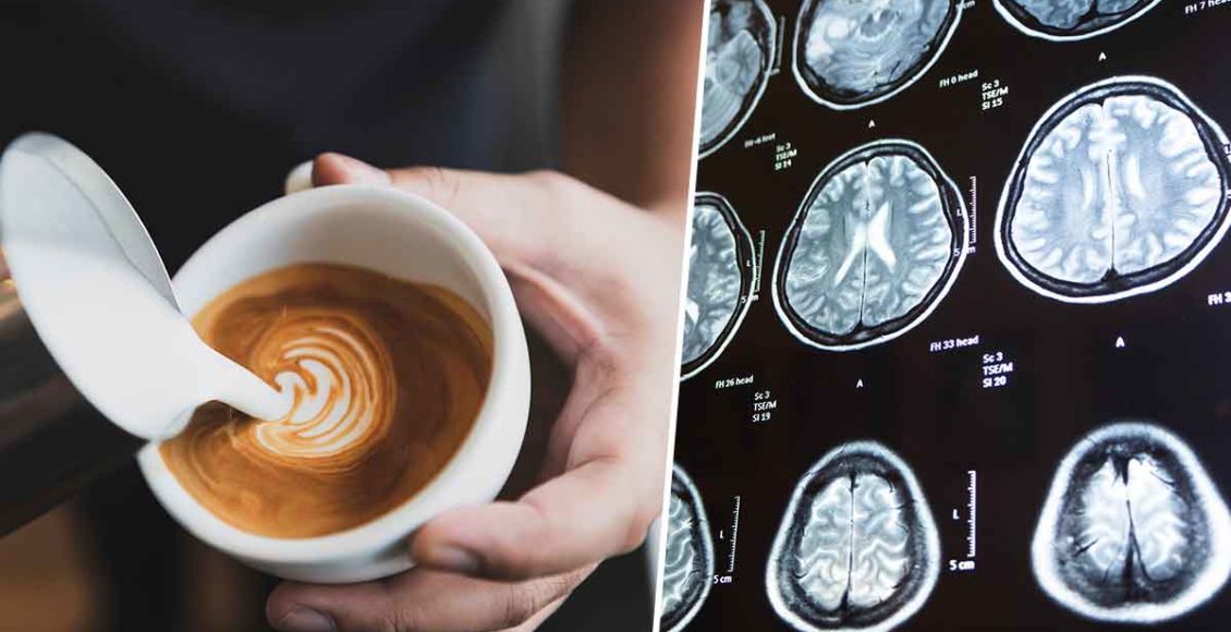 High Coffee Consumption Linked To Smaller Brain Volume, New Findings Suggest