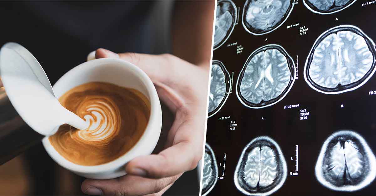 High Coffee Consumption Linked To Smaller Brain Volume, New Findings Suggest