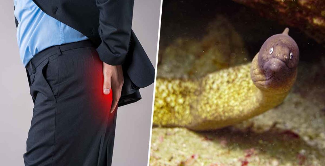 Man Almost Dies After Putting Eel Into His Rectum To Cure Constipation