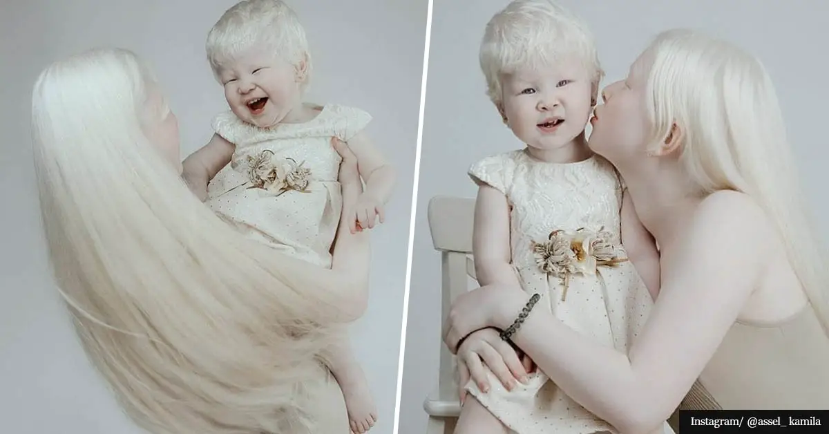 Stunning Albino sisters born 12 years apart become modeling phenomenon