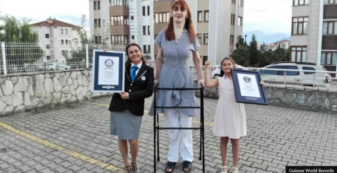 7-Foot-Tall Turkish Woman Confirmed As World's Tallest Living Woman