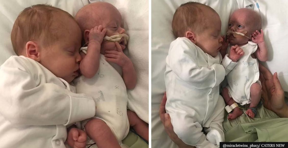 Parents say baby born just 1lb has 'kept fighting' thanks to cuddles from identical twin brother