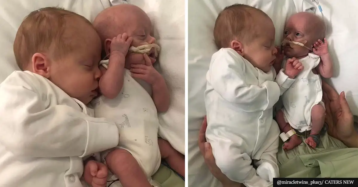 Parents say baby born just 1lb has 'kept fighting' thanks to cuddles from identical twin brother