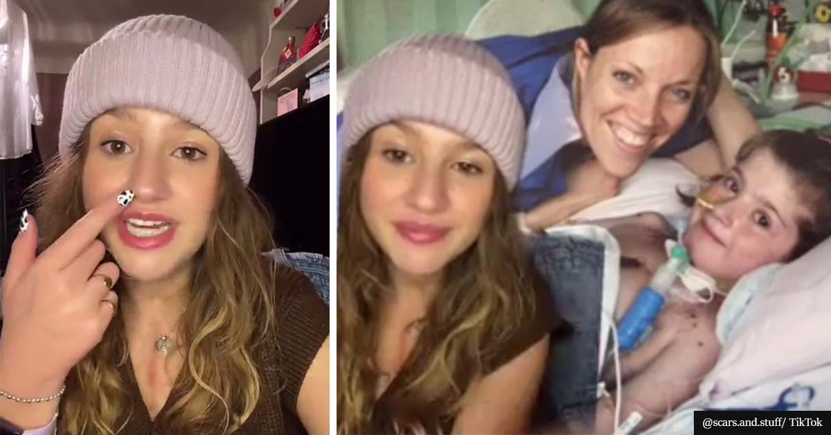VIRAL VIDEO: Woman Tells Story Of How She Had To Breathe Out Of Her Neck For 8 Months