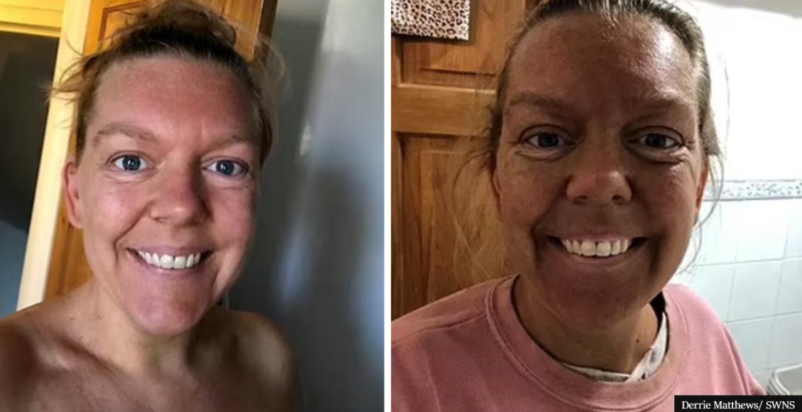 Woman 'AGHAST' after double spray tan leaves her looking like Ross from Friends