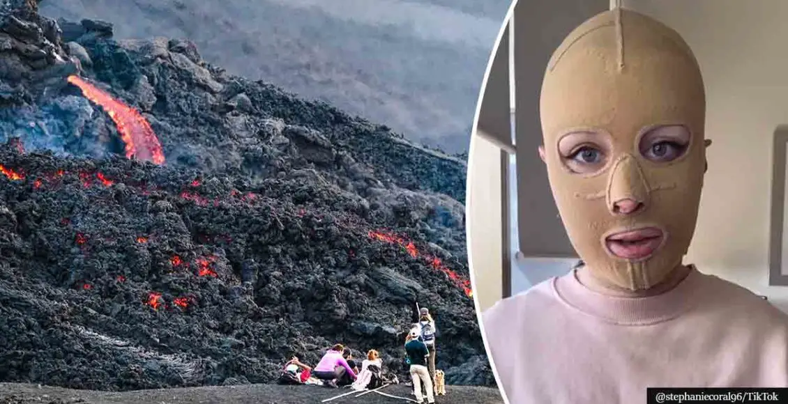 Woman Who Survived A Volcano Eruption Recalls The Horrific Day That Changed Her Life Forever