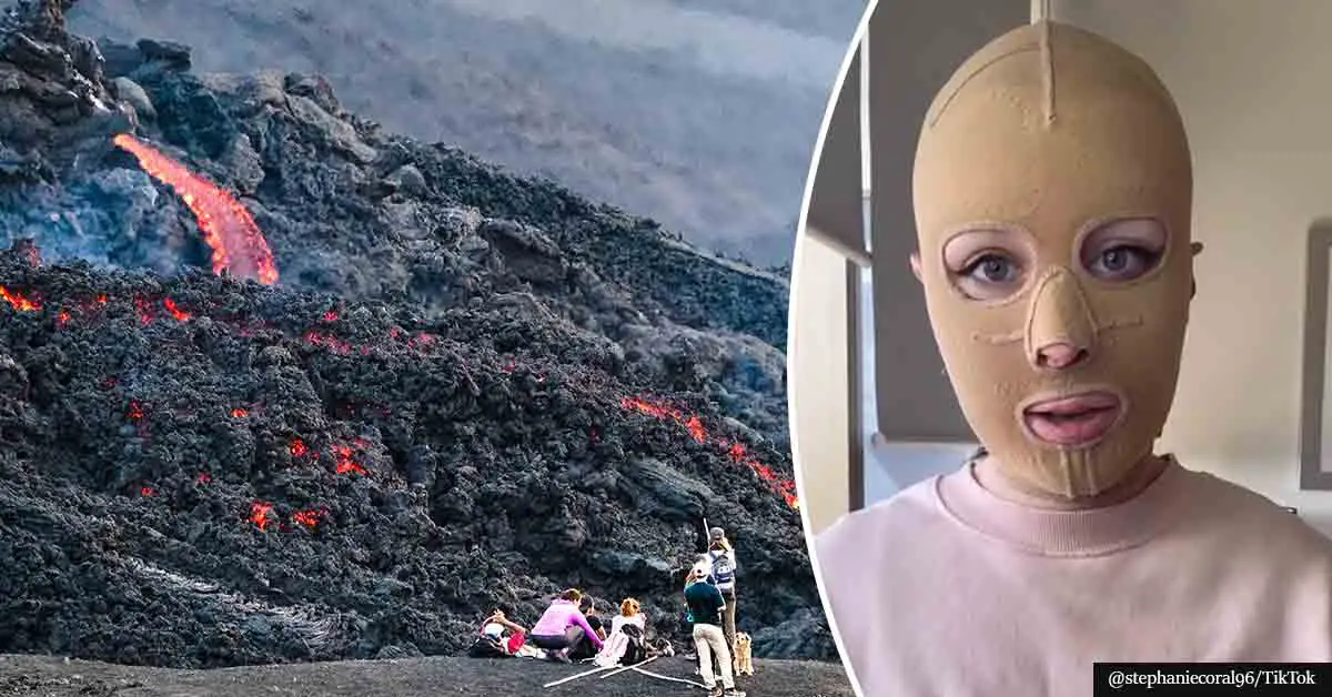 Woman Who Survived A Volcano Eruption Recalls The Horrific Day That Changed Her Life Forever