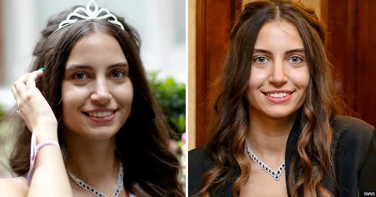 Miss England Finalist Becomes First Make-Up-Free Beauty Queen In Pageant's History